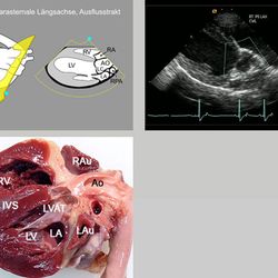 Anatomie der Längsachse